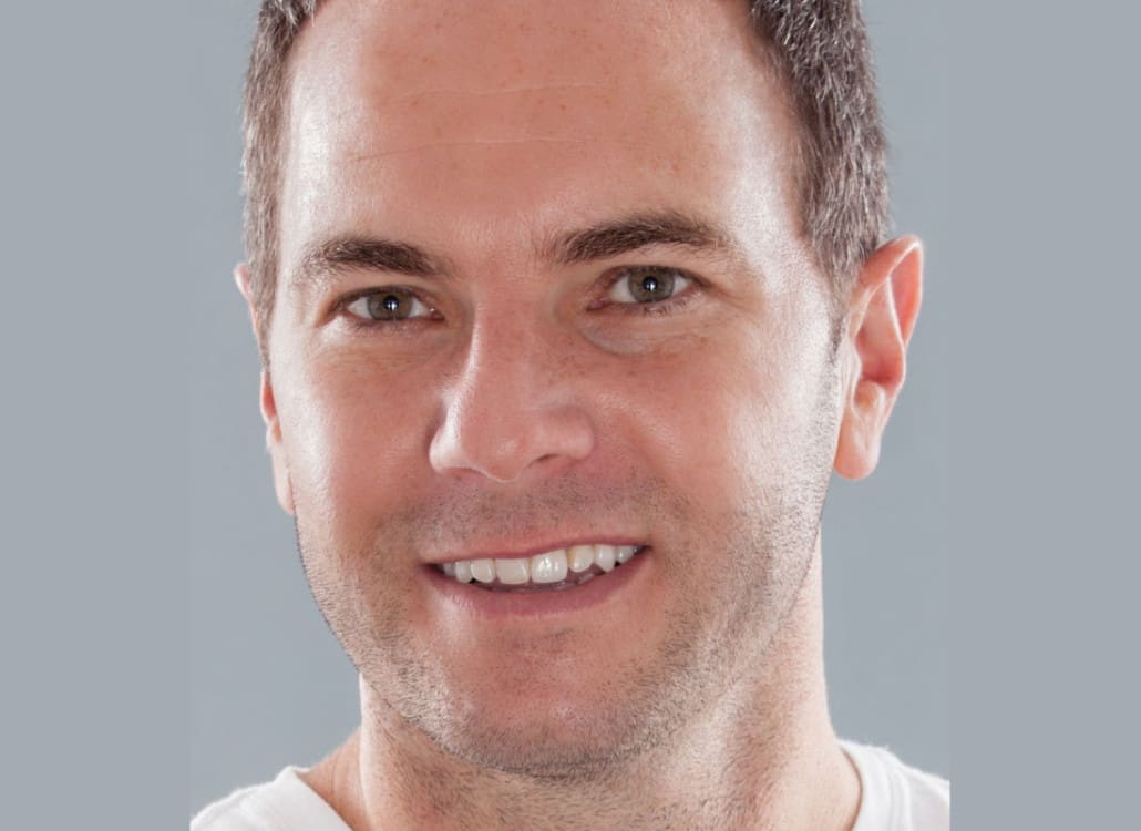 Chris-Barton
